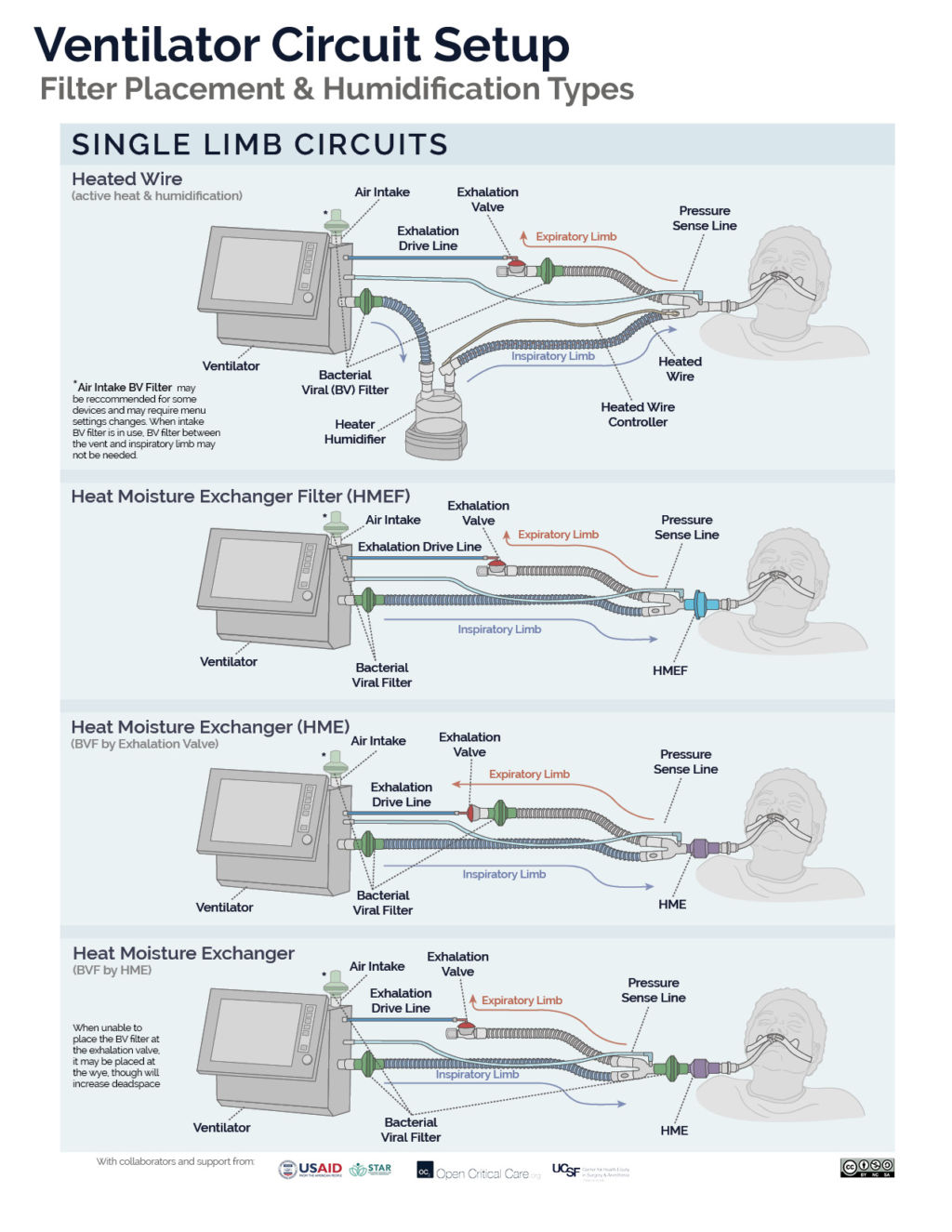 Oxygen FAQ Open Critical Care