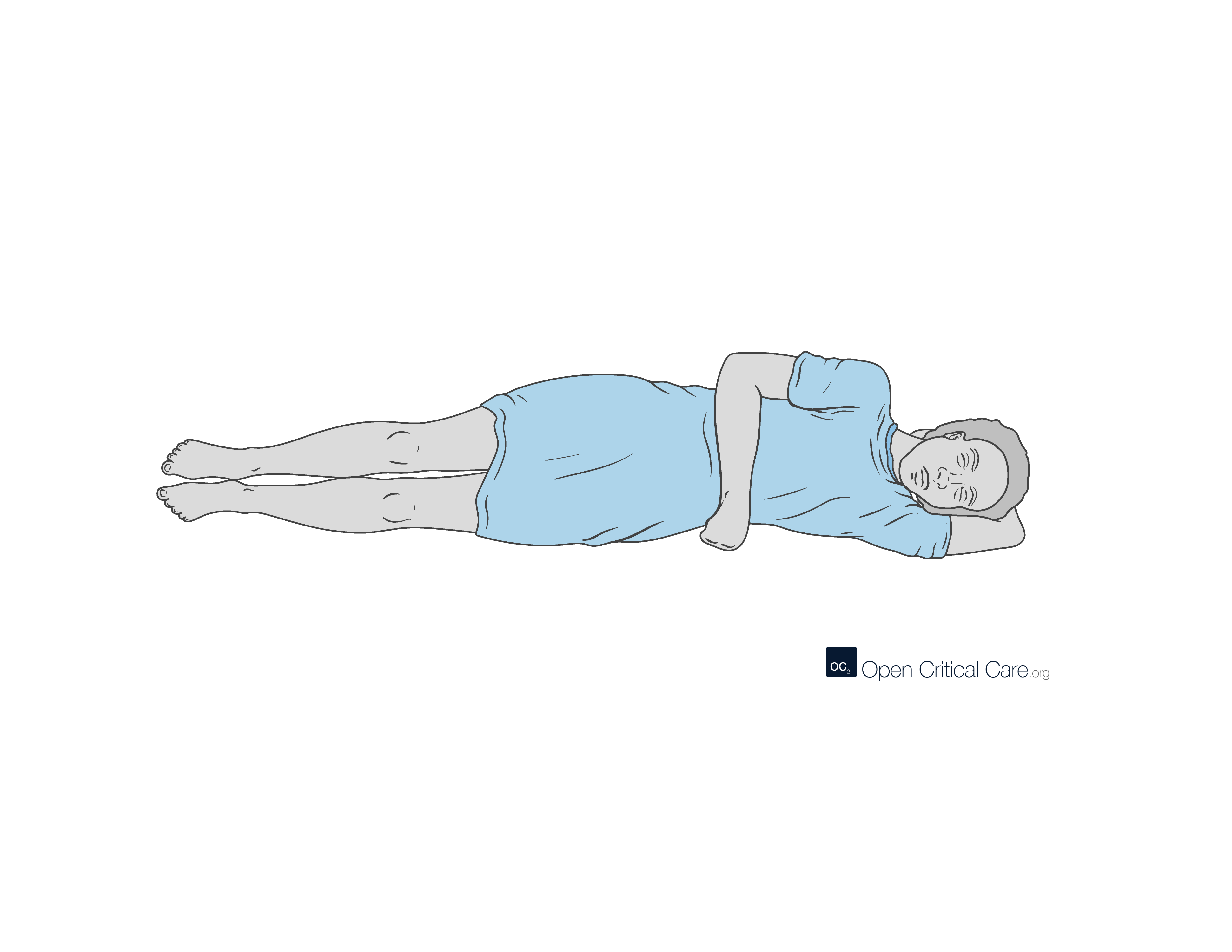 Left Lateral Recumbency position - Open Critical Care