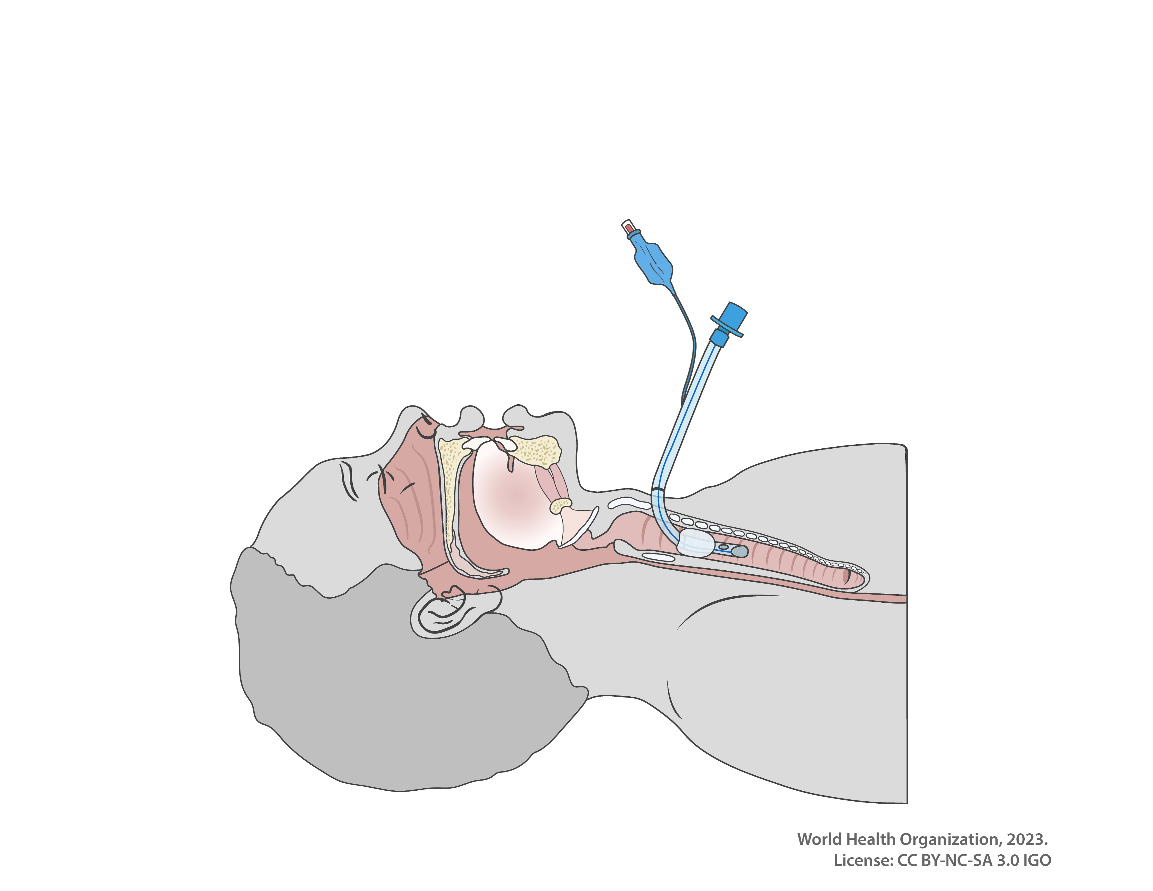 Image Library - Open Critical Care